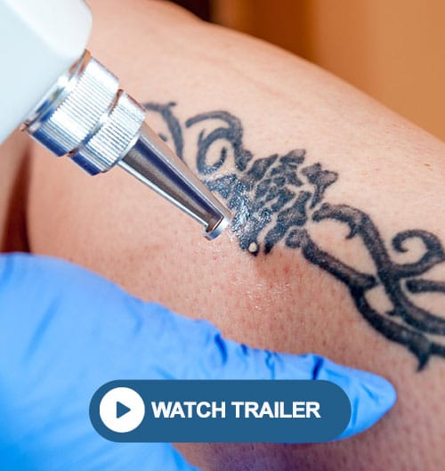Laser tattoo removal technician certification training using Q-switched laser technology